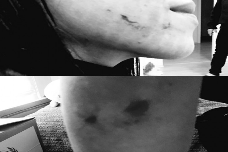 Bakıda qadın sığınacağına hücum: əri, qaynanası, baldızı ... -YENİLƏNİB 