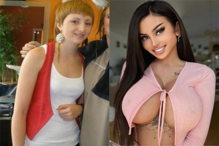 Gözəlləşmək üçün çoxlu əməliyyat keçirdi:  oğlanlar onu bəyənmirlər 