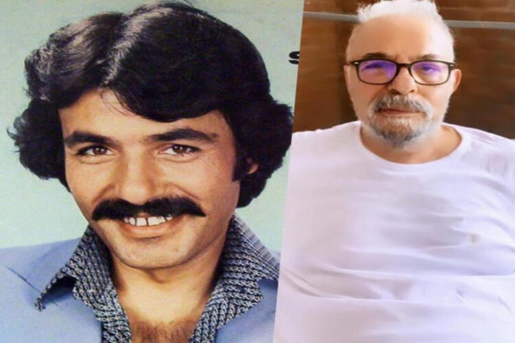 Məşhur müğənni tanınmaz halda -FOTO 