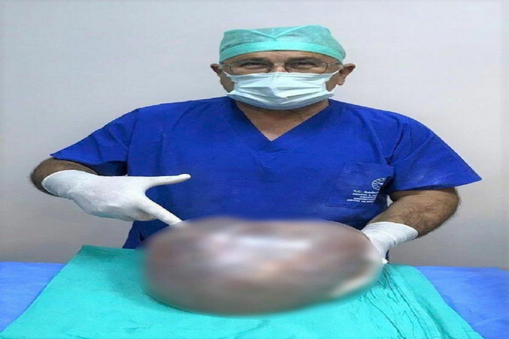 Qadının qarnından çıxan hər kəsi ŞOK ETDİ 