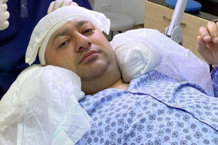 Tanınmış aktyor başına tük əkdirdi - FOTO 