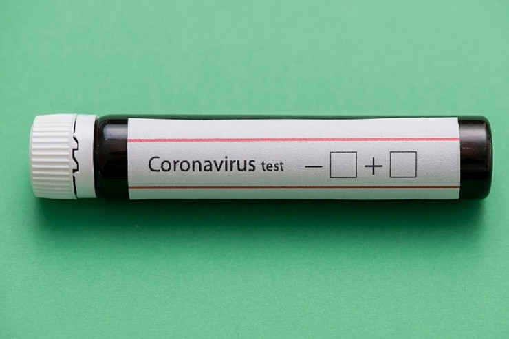 Koronavirusa yeni yoluxma və ölüm  STATİSTİKASI 