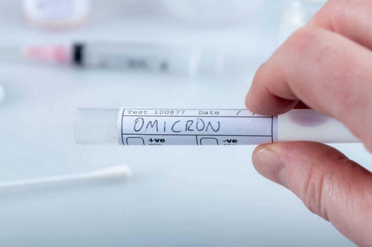 Azərbaycanda "Omicron"  ştammı aşkarlanıbmı? - CAVAB 