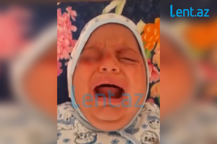 Azərbaycanda gözlərindən qan gələn uşaqla bağlı YENİ XƏBƏR  - "Hələ də..." 
