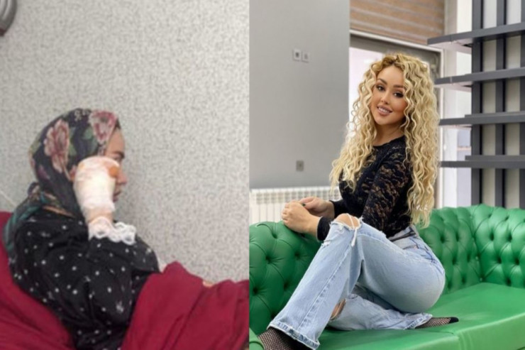 "Gecə klubuna sahura getmişdim" - Bardakı partlayışda yaralanan qız 