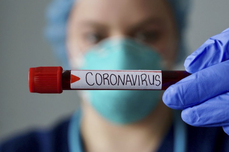 Koronavirusdan ölən olmadı - SON STATİSTİKA 