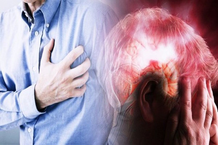 Niyə bazar ertəsi  infarkt və insult riski   artır?