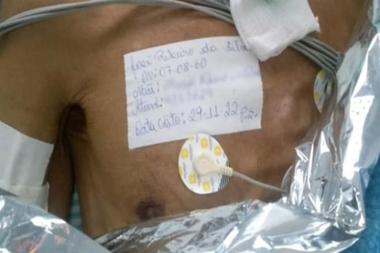 Ölü kimi meyit torbasına QOYULDU: 5 saat sonra... 