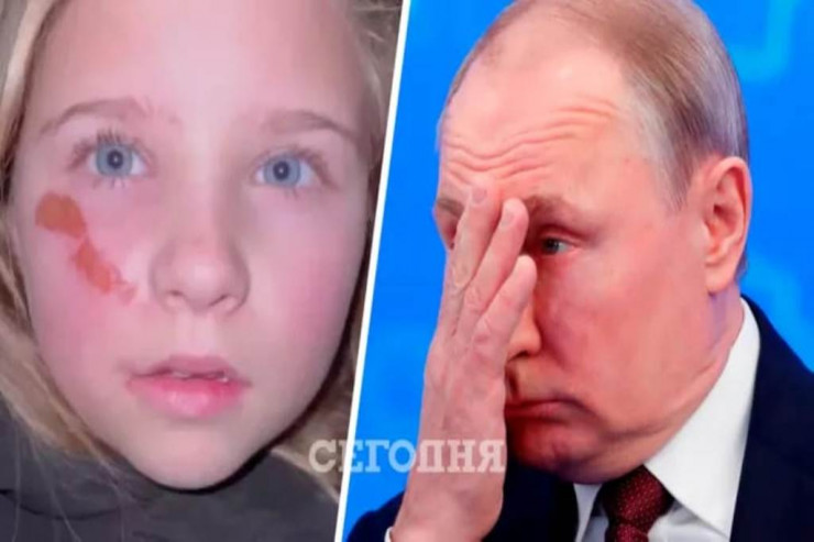 Ukrayna uşaqlarından Putinə  MÜRACİƏT  - VİDEO  