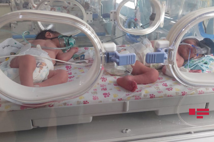 Azərbaycanda ilin ilk körpələri əkiz oğlandır -FOTO  -YENİLƏNİB 