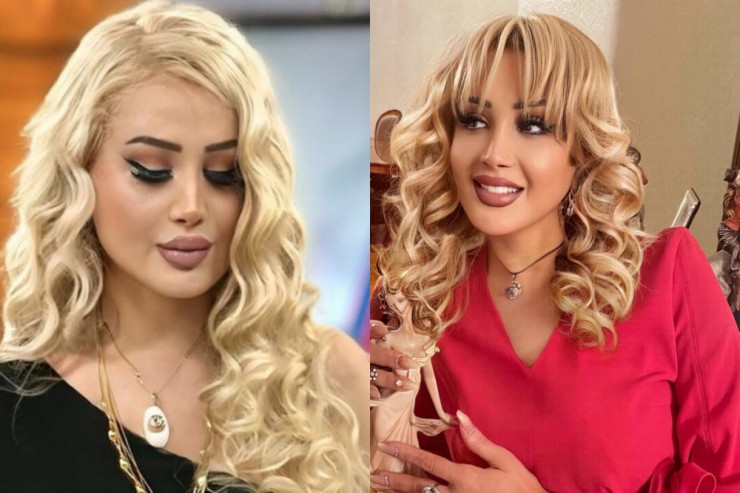 Xalq artisti geyimindən danışdı: "Zəngin görünüm..."  