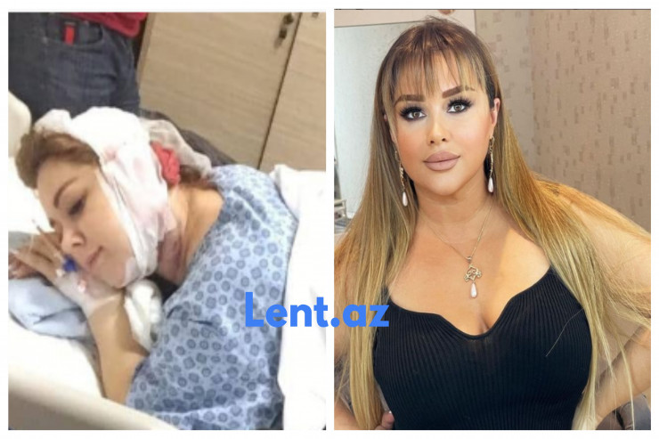 Xatirə əməliyyat masasından FOTOSUNU  paylaşdı