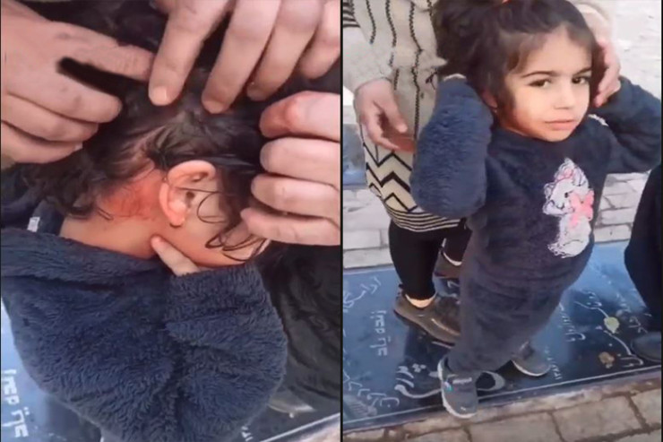 SEPAH terrorçuları daha bir körpəyə güllə atdı - VİDEO 