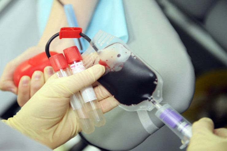 Qan analizi ilə hansı xəstəliklər AŞKARLANIR? - CAVAB 