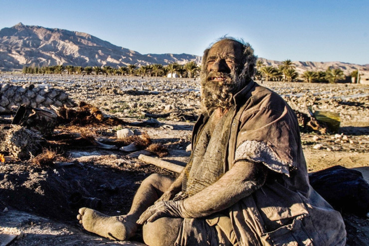 Dünyanın ən çirkli adamı çiməndən sonra   ÖLDÜ