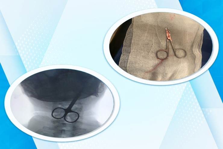 Bakıda qadın özünü öldürmək üçün QAYÇI UDDU  - YENİLƏNİB 