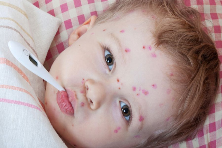 Uşaqlara nə vaxt  antibiotik vermək olar?   - Həkimdən CAVAB