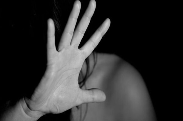 Azərbaycanda DƏHŞƏT:  Ata qızını "kislota" ilə yandırdı