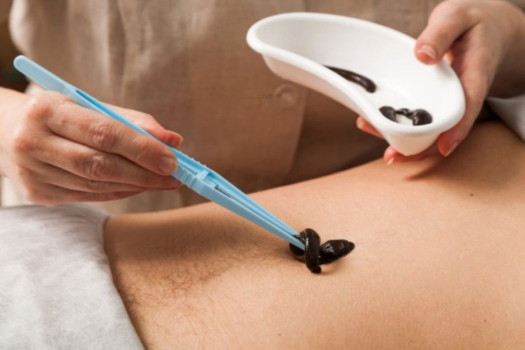 Zəli müalicəsində FIRILDAQÇILIQ:  Bunlardan qaçın 