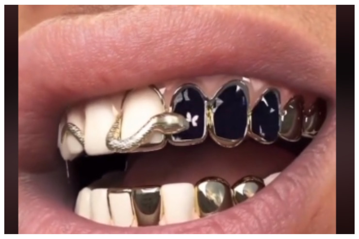 Yeni əcaib diş protezləri -  İçindən ilan çıxır 