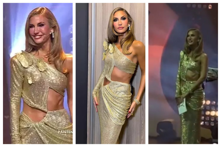 Çağla Şikeli  afrikalı xəstə uşaqlara bənzətdilər