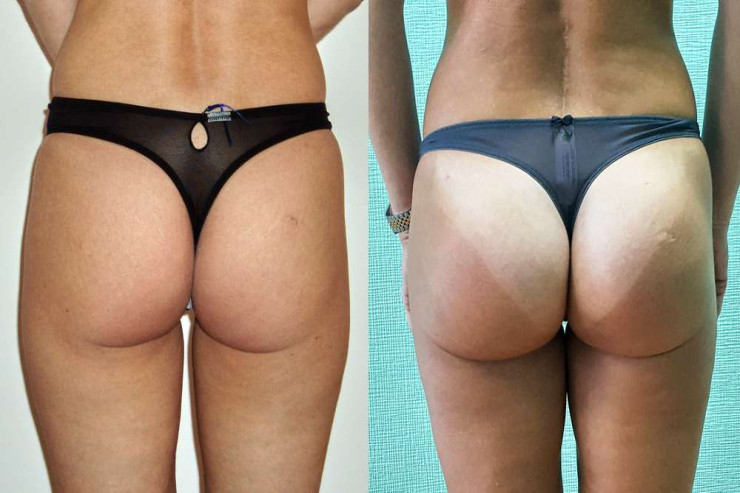 Xalq artistinin ombası çürüyür 