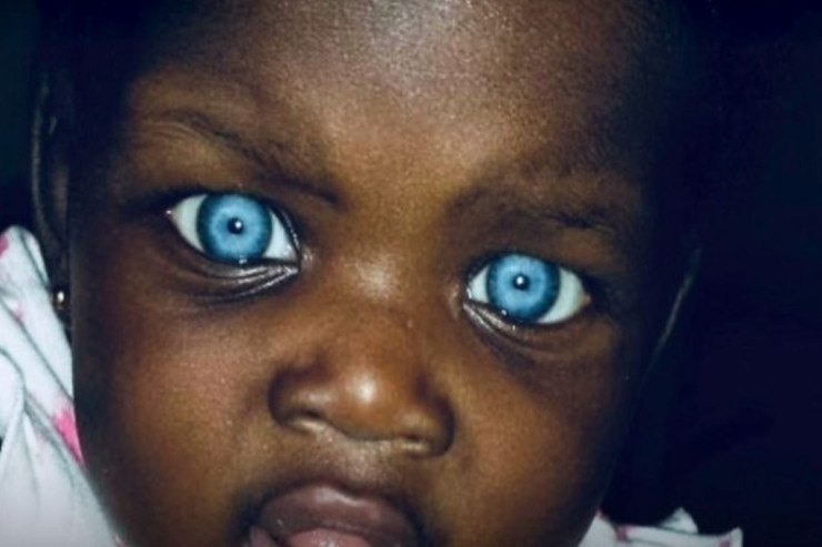 Bu gözləri görənlər heyrətə düşürlər - FOTOLENT 