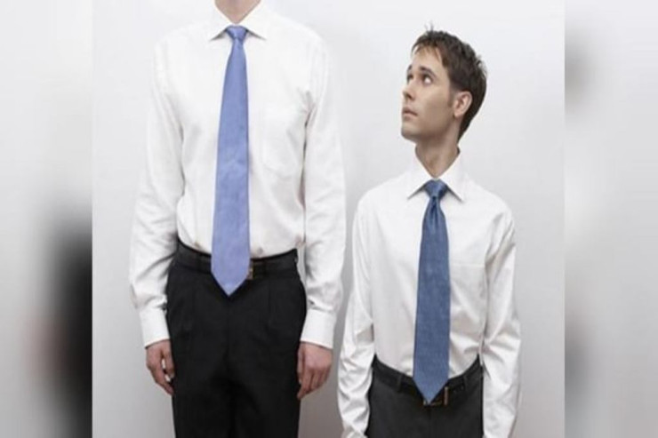 Qısaboylu adamlarda bu xüsusiyyətlər OLUR 