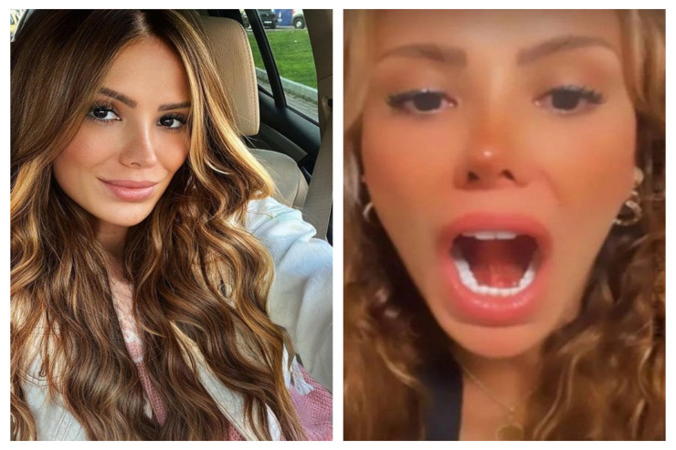 Öpüşəndə dili qopdu - FOTO 