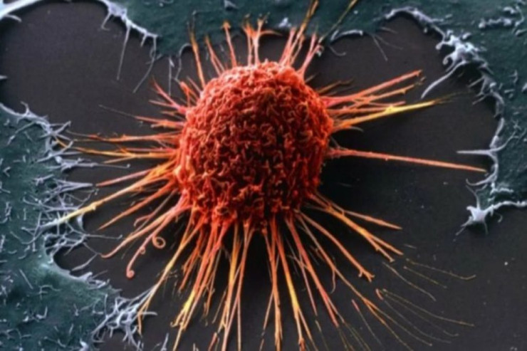 Bu məhsullarda  xərçəngdən xilas edən   unikal maddələr tapıldı