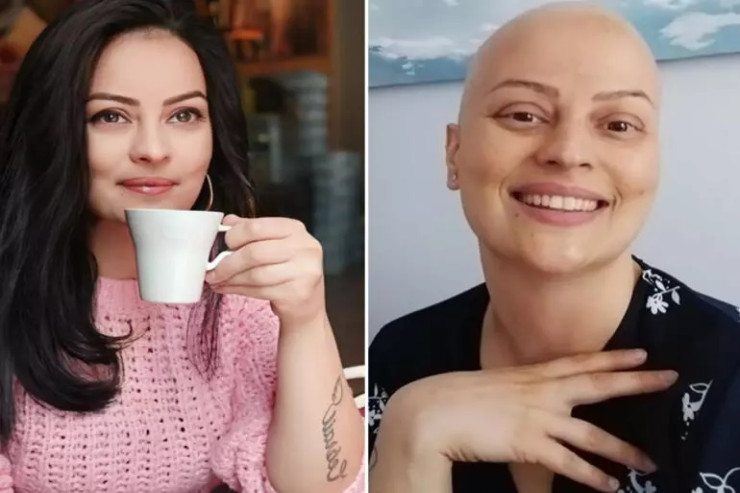 Məşhur aktrisadan MESAJ:  Xərçəngə baxmayaraq gülümsə 