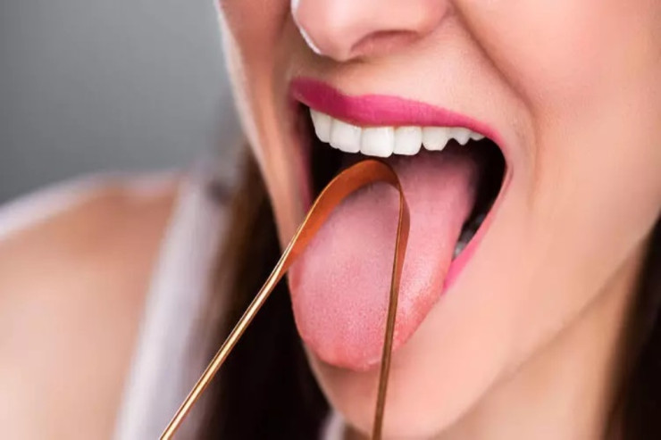  Çirkli dil   hansı ağız problemlərinə səbəb olur? - CAVAB 