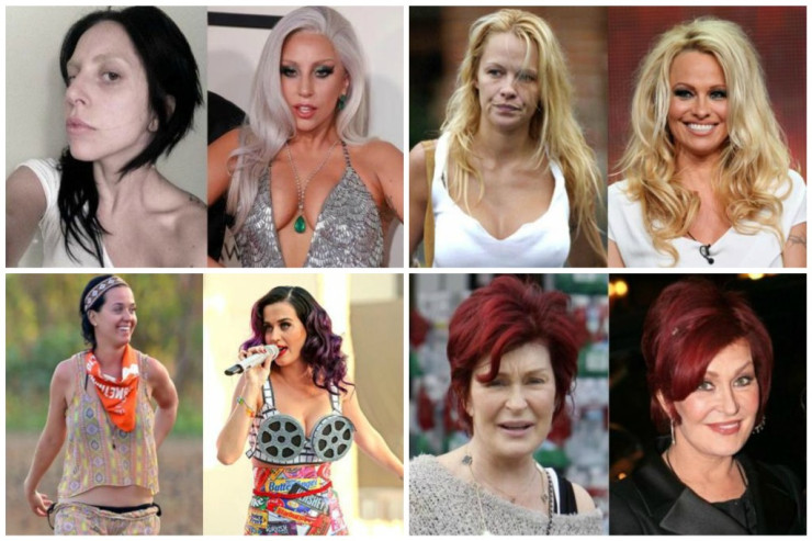 Ulduzların GÖZƏLLİK SİRLƏRİ-  Babasil dərmanı,  kürü, arı zəhəri