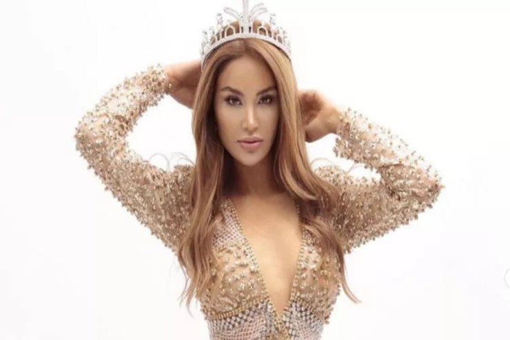 Öncə model, sonra aktrisa oldu, ən sonda göyə uçdu 