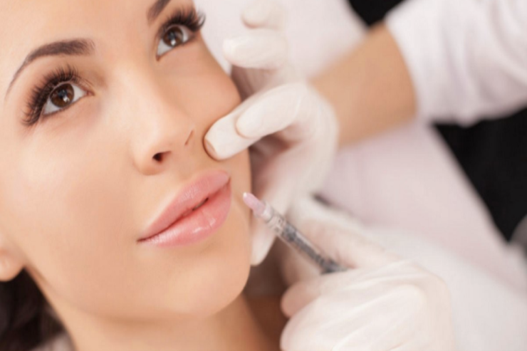 Dodaq dolğusundan sonra niyə dərin qırışlar yaranır?