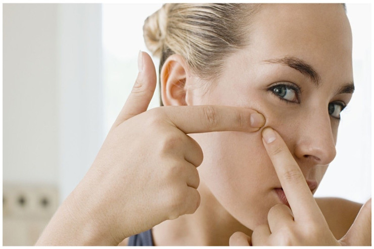 Dərini cavanlaşdırır, sızanaqların qarşısını alır - İNANMAYACAQSIZ 