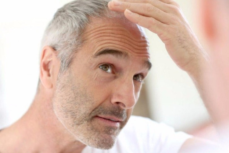 DİQQƏT!  Bu qidalar saçları ağardır