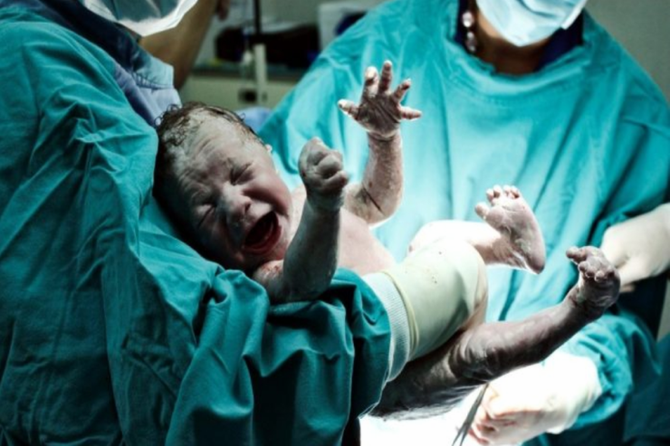 Erkən doğulmuş körpələrdə ağciyər xəstəliyi İNKİŞAF EDİR - MÜSAHİBƏ 