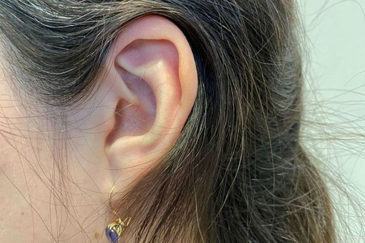 Qadın qulağındakı pambığa görə   komaya düşdü