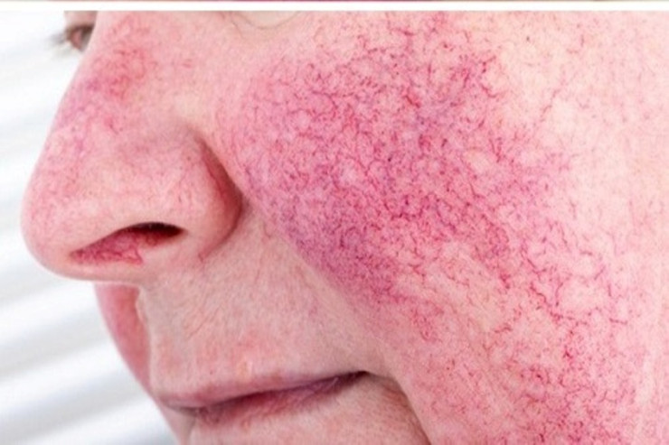 Ev prosedurları üz dərisi üçün ZƏRƏRLİDİR 