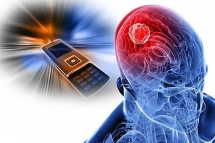 Smartfonlar  qan təzyiqi riskini   artırır - ARAŞDIRMA