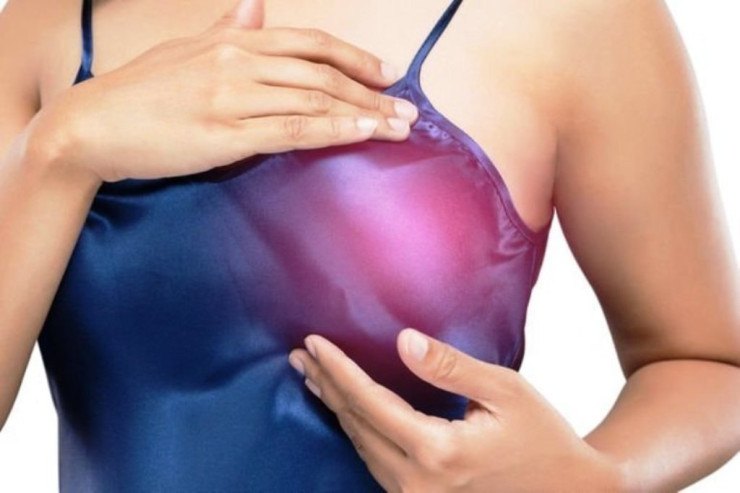 Süd vəzi xərçəngi ilə bağlı MİFLƏR DAĞIDILDI 