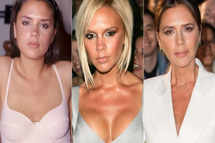 Viktoriya Bekhem tanınmaz halda 