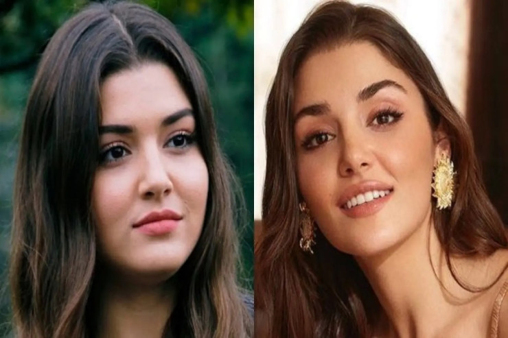 Estetik əməliyyatlarla bağlı sualı eşidib  qəzəbləndi 