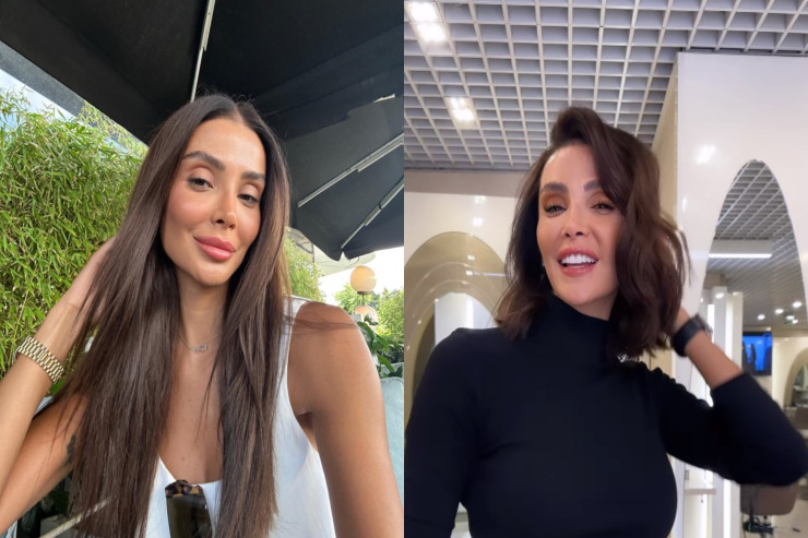 Tanınmış model  imicini dəyişdi   