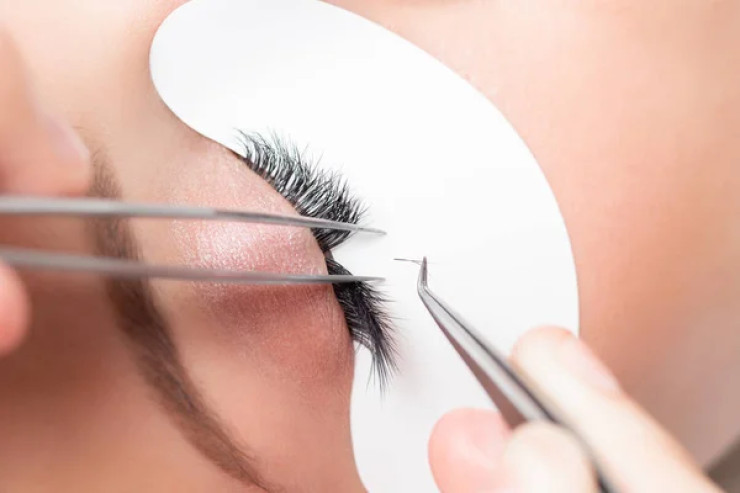  Kirpik proseduruna   görə xəstəxanaya düşdü