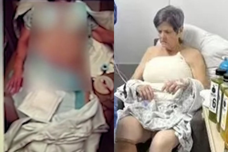 Yaşlı qadının başqa əməliyyat adı ilə  DÖŞÜNÜ BÖYÜTDÜLƏR 