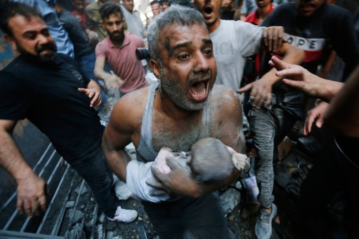 Qəzzadan   dəhşətli görüntülər -  FOTOLENT 