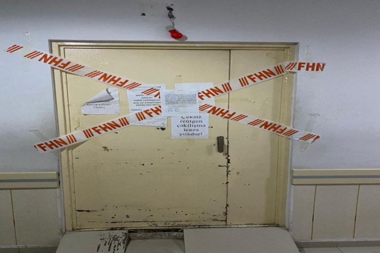 Respublika Klinik Xəstəxanasında rentgen kabinetləri BAĞLANDI   - FOTO 