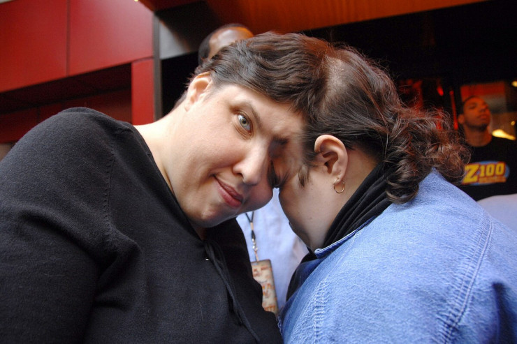 Dünyanın ən yaşlı  siam əkizləri   vəfat etdi